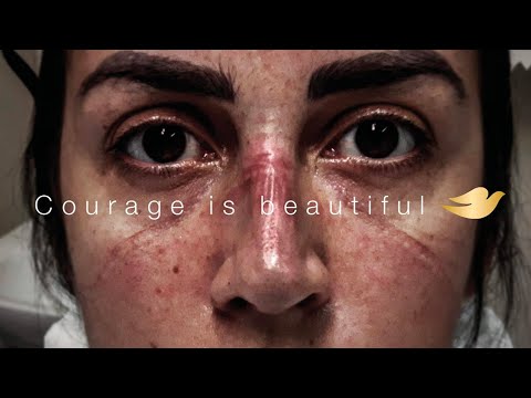 Dove – Real Beauty: How a Soap Brand Created a Global Self-Esteem Movement (case study) – youtube